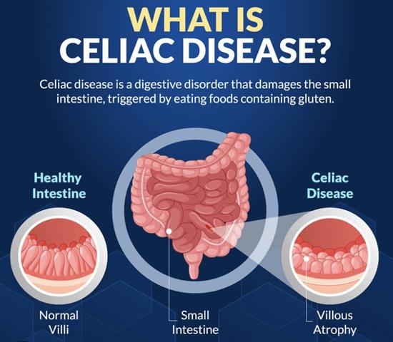 Celiac